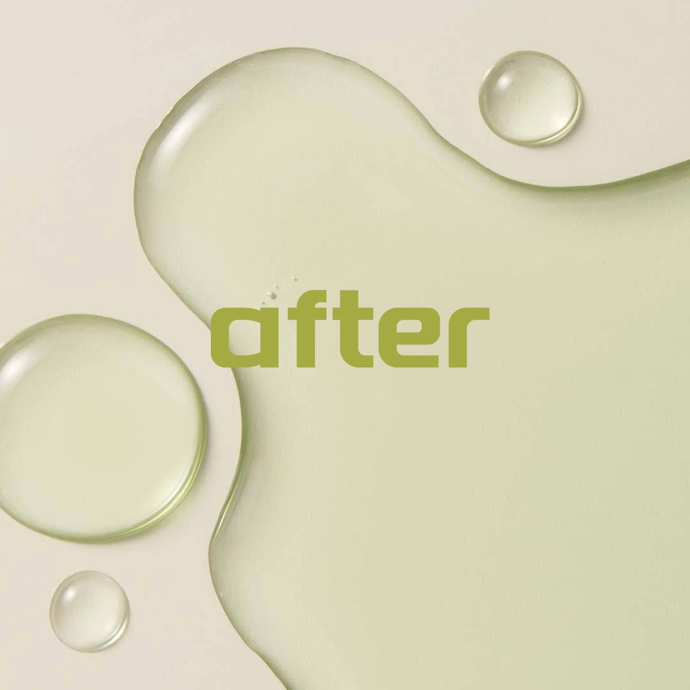 XY-230104-ZTQXYLOGOT-8