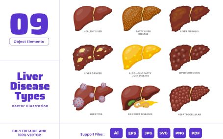 肝脏疾病示意图 – 人体内部器  (AI,EPS,JPG,PDF,PNG,SVG)
